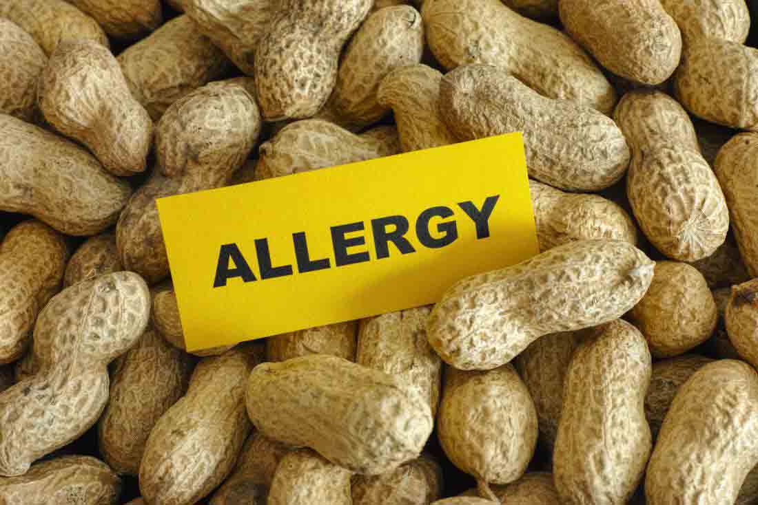 Peanut Allergy